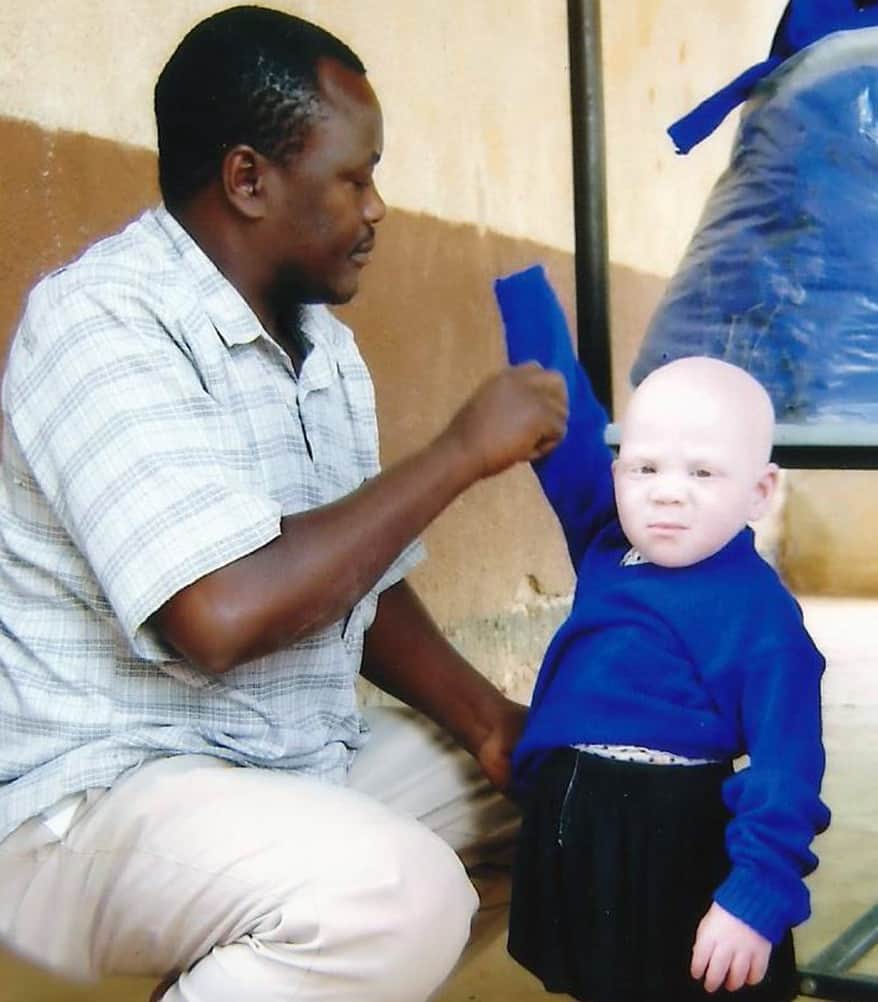 Ministry for People with Albinism