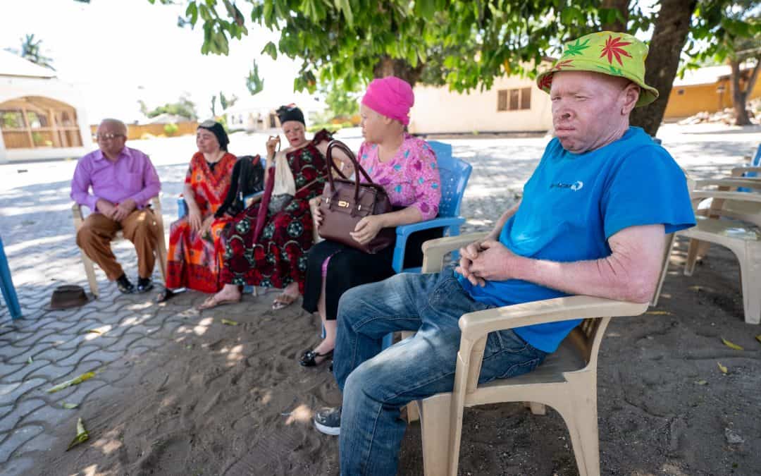 Ministry for People with Albinism ✔